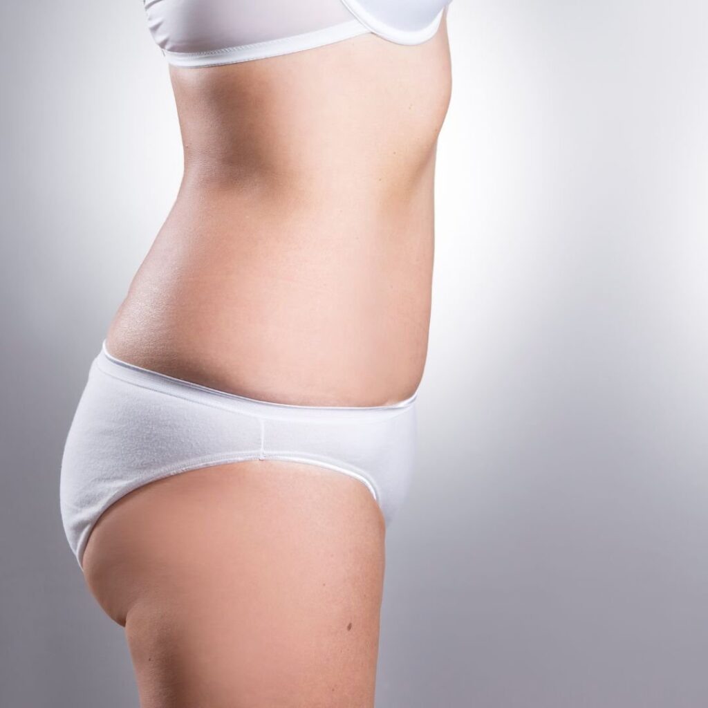 TightSculpting™ — after