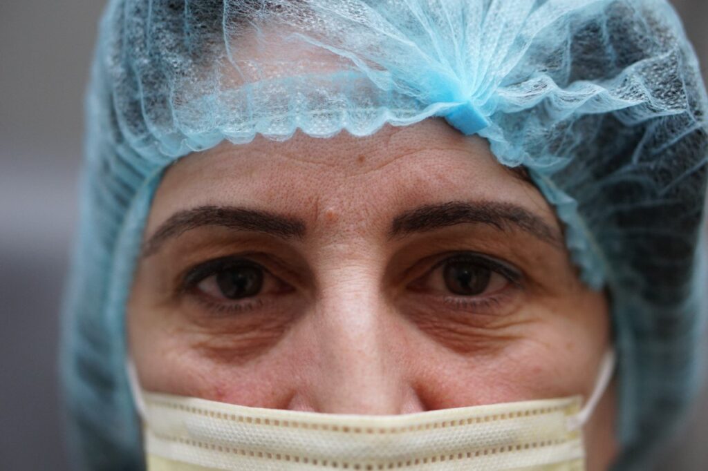 Lower Eyelid Surgery — before