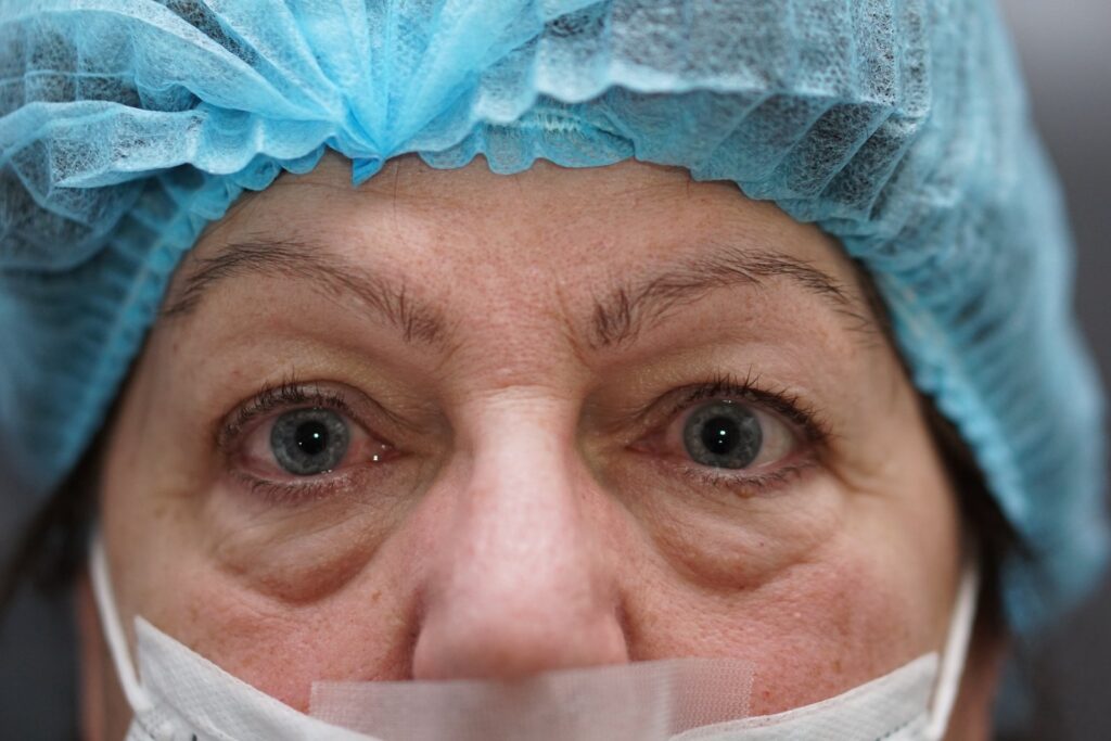 Lower Eyelid Surgery — before