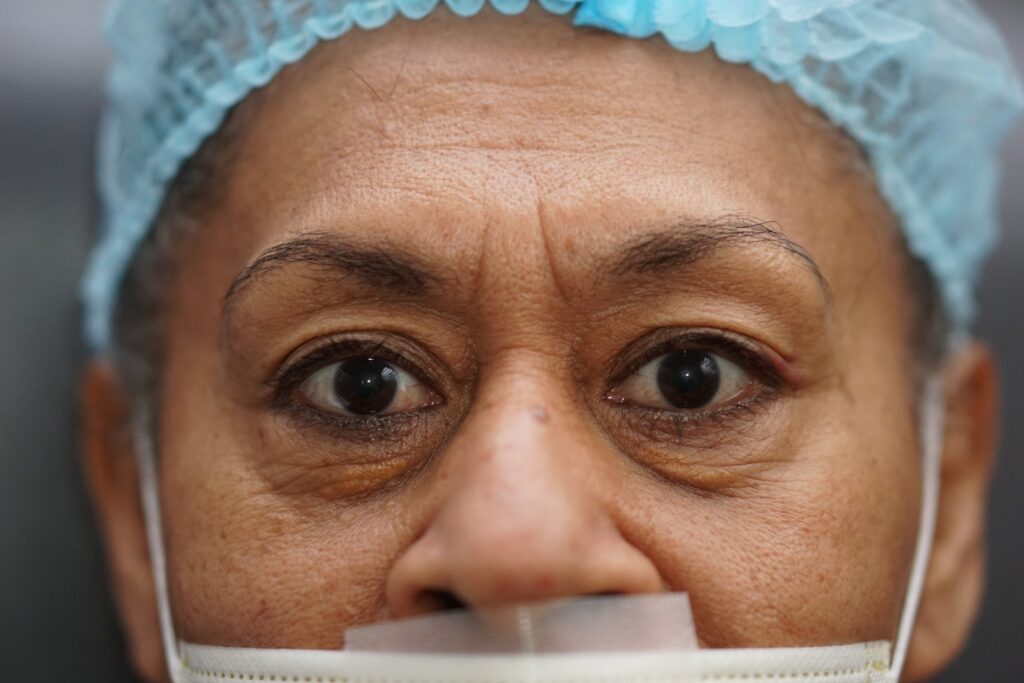 Lower Eyelid Surgery — before