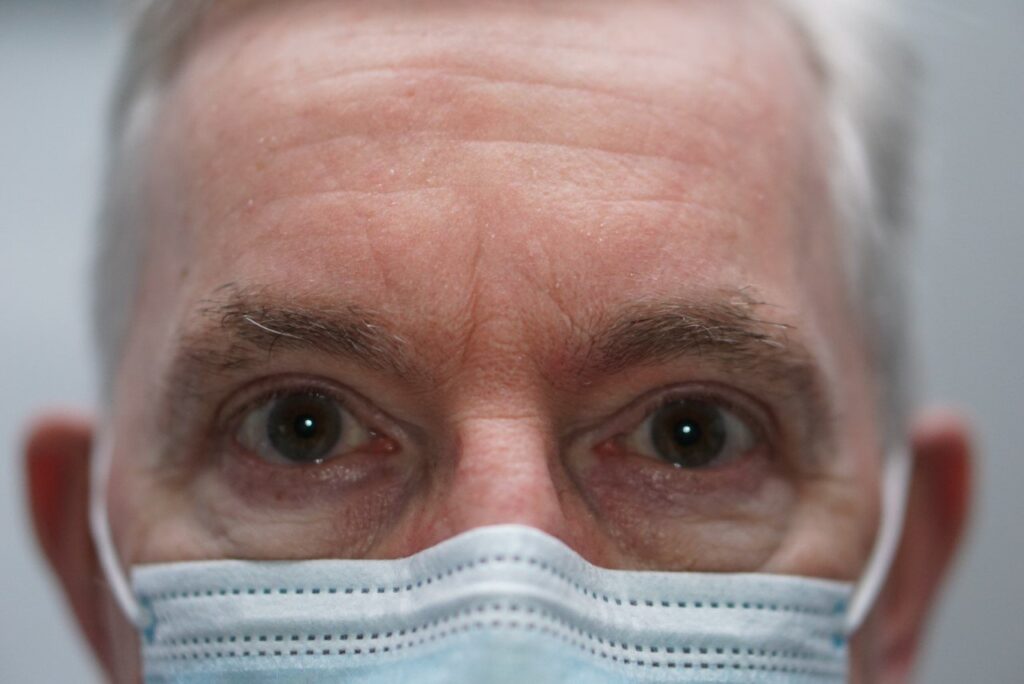 Upper Eyelid Surgery — after