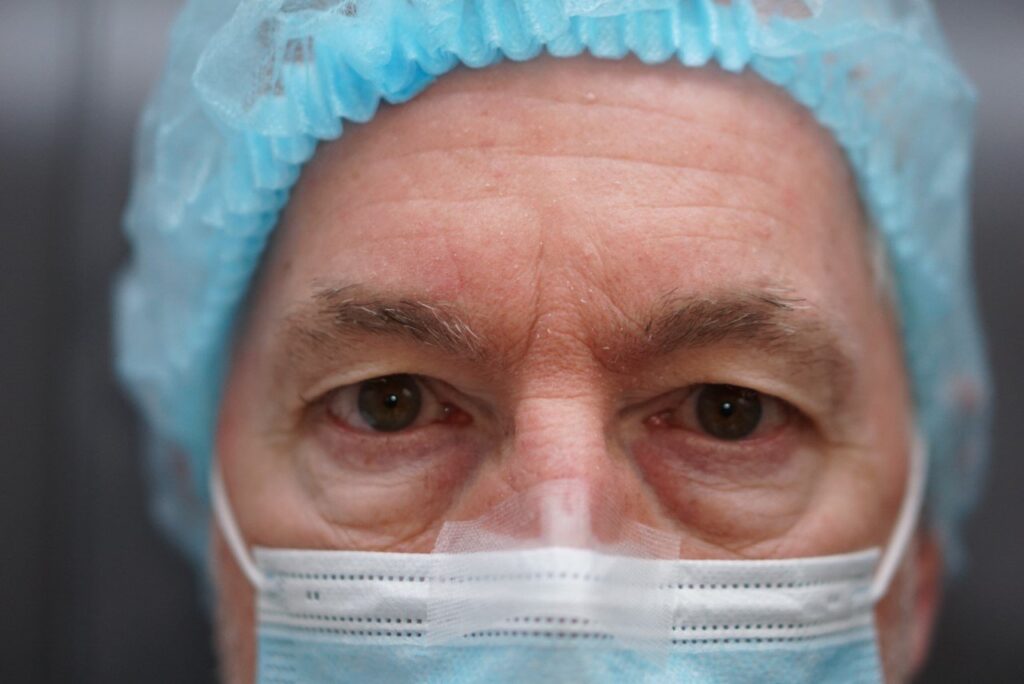 Upper Eyelid Surgery — before