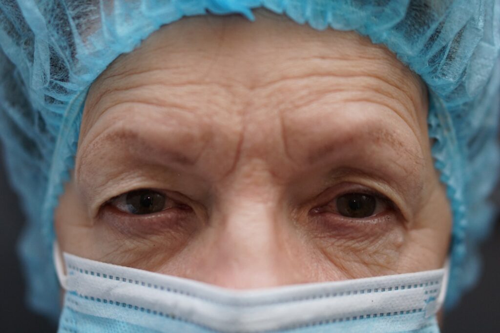 Upper Eyelid Surgery — before