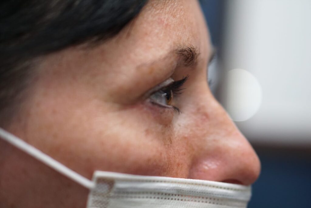 Lower Eyelid Surgery — after