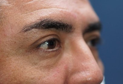 Brow Pexy — after